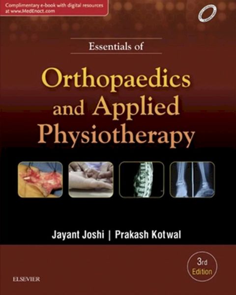 Essentials of Orthopaedics & Applied Physiotherapy(Kobo/電子書)