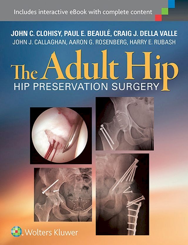  The Adult Hip(Kobo/電子書)