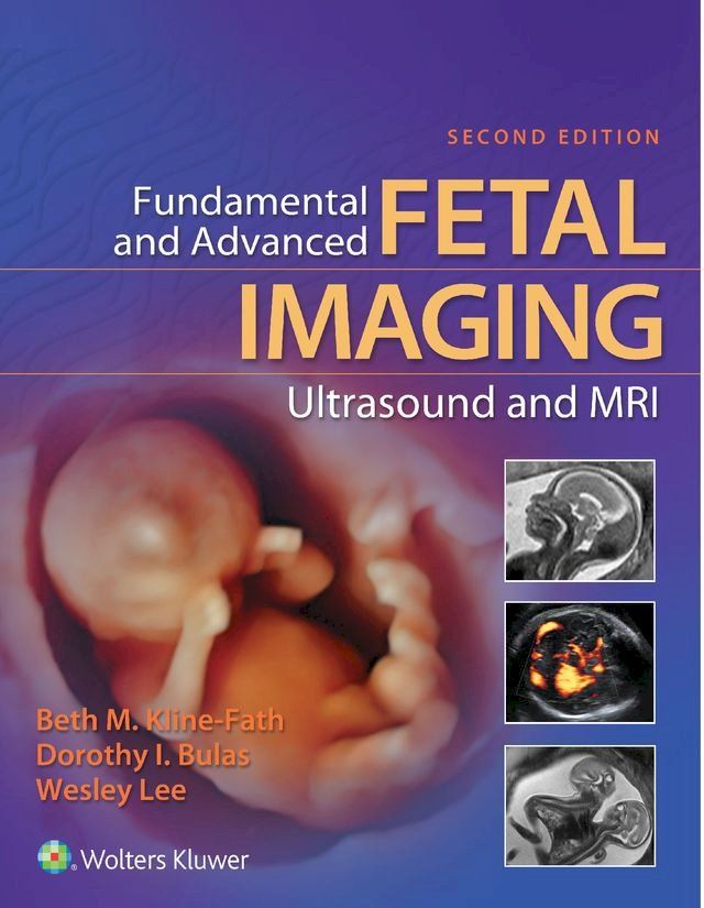  Fundamental and Advanced Fetal Imaging Ultrasound and MRI(Kobo/電子書)