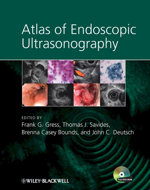  Atlas of Endoscopic Ultrasonography(Kobo/電子書)