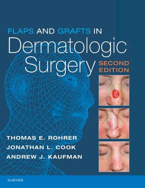 Flaps and Grafts in Dermatologic Surgery(Kobo/電子書)