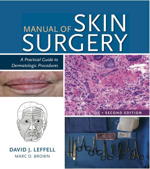 Manual of Skin Surgery(Kobo/電子書)