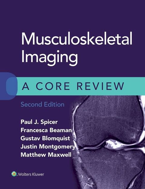 Musculoskeletal Imaging: A Core Review(Kobo/電子書)