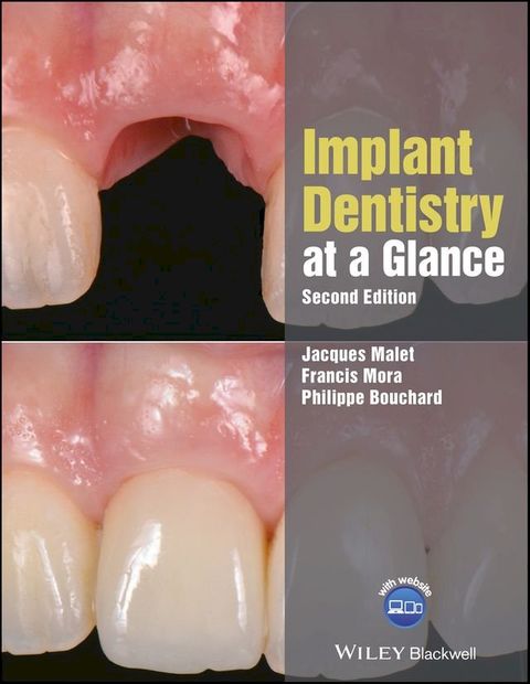 Implant Dentistry at a Glance(Kobo/電子書)