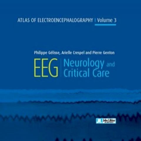 Atlas of Electroencephalography - Volume 3 - Neurology and Critical Care(Kobo/電子書)