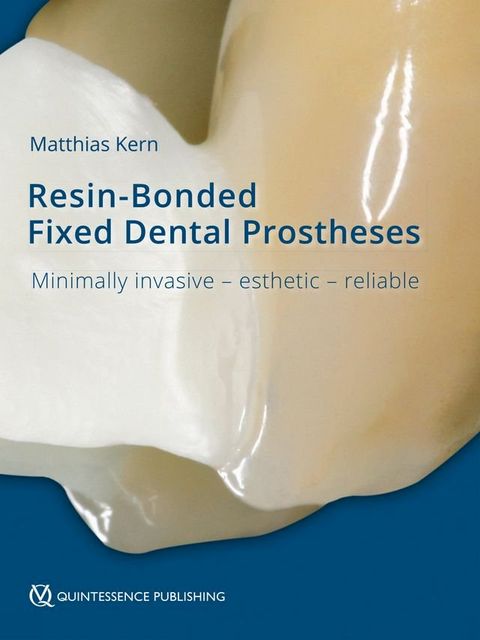 Resin-Bonded Fixed Dental Prostheses(Kobo/電子書)