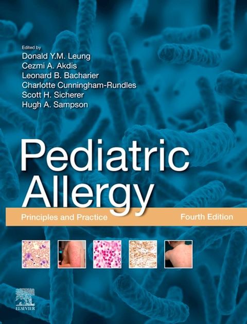 Pediatric Allergy(Kobo/電子書)