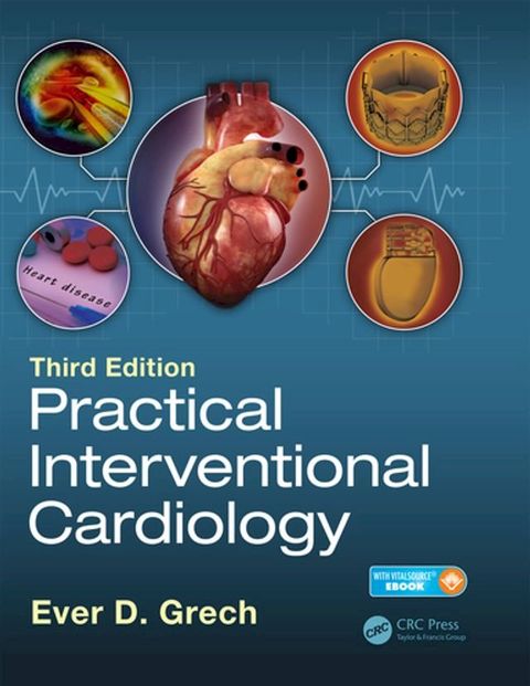 Practical Interventional Cardiology(Kobo/電子書)