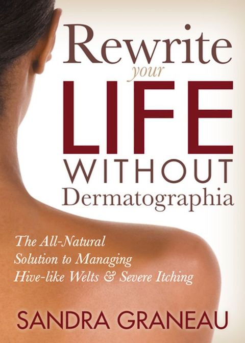 Rewrite Your Life Without Dermatographia(Kobo/電子書)