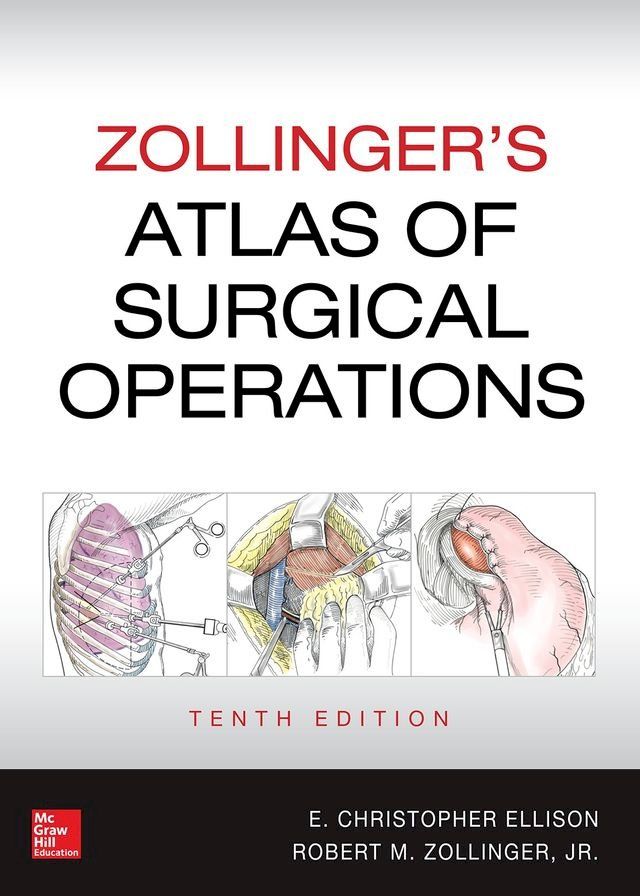  Zollinger's Atlas of Surgical Operations, 10th edition(Kobo/電子書)