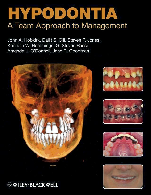  Hypodontia(Kobo/電子書)