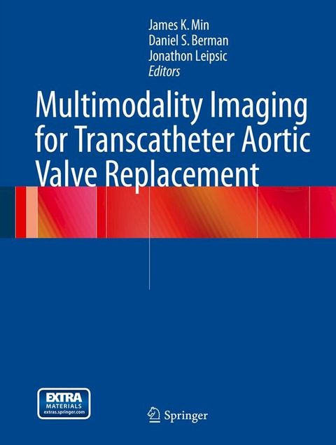 Multimodality Imaging for Transcatheter Aortic Valve Replacement(Kobo/電子書)