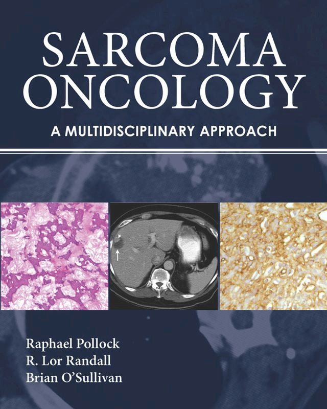  Sarcoma Oncology(Kobo/電子書)