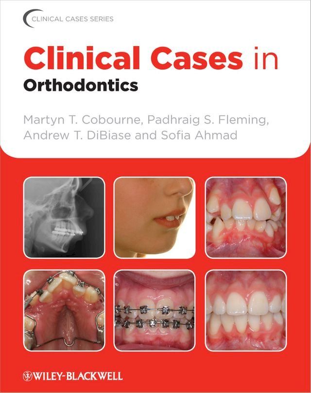  Clinical Cases in Orthodontics(Kobo/電子書)