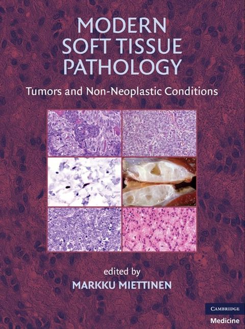 Modern Soft Tissue Pathology(Kobo/電子書)