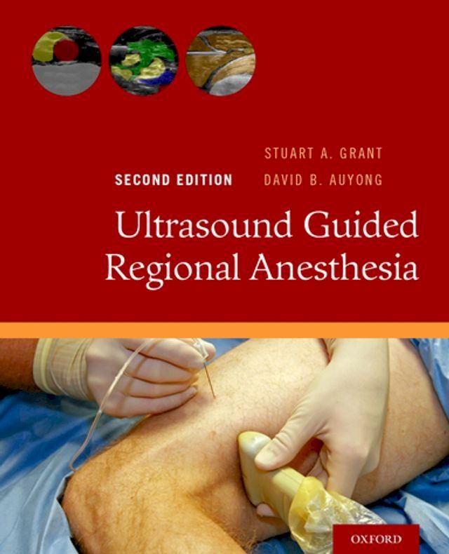  Ultrasound Guided Regional Anesthesia(Kobo/電子書)