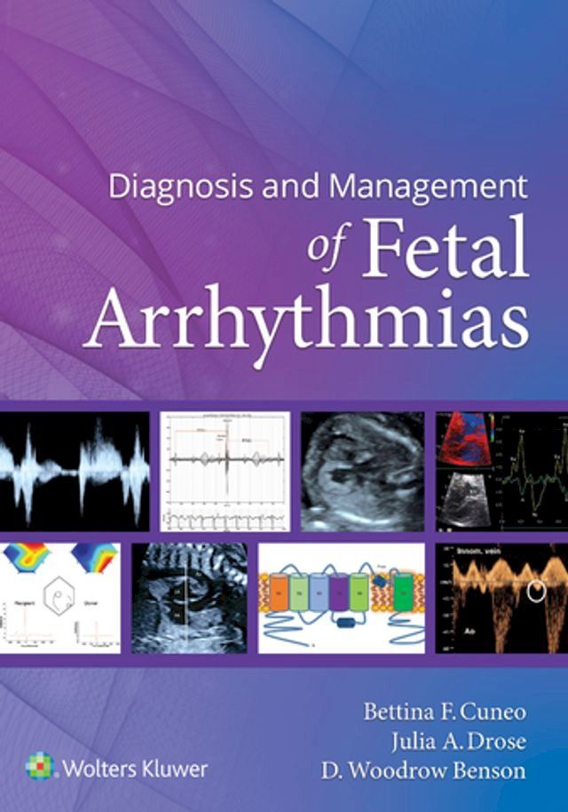  Diagnosis and Management of Fetal Arrhythmias(Kobo/電子書)