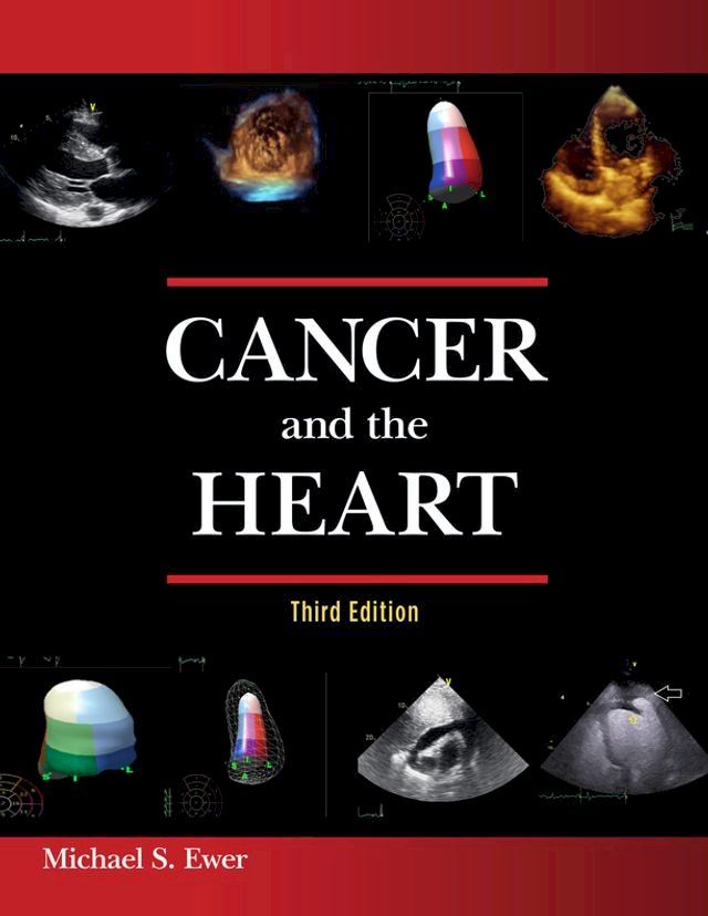  Cancer and the Heart(Kobo/電子書)