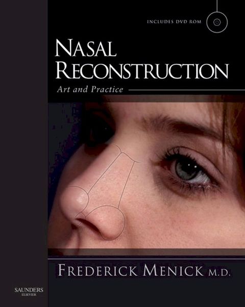 Nasal Reconstruction: Art and Practice(Kobo/電子書)