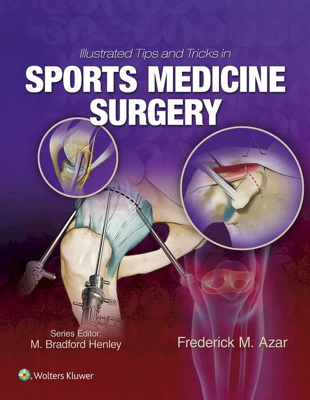  Illustrated Tips and Tricks in Sports Medicine Surgery(Kobo/電子書)