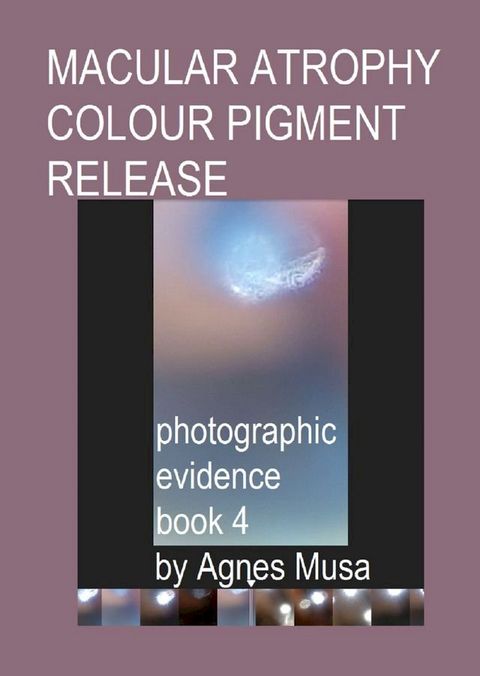 Macular Atrophy Colour Pigment Release, Photographic Evidence Book 4(Kobo/電子書)