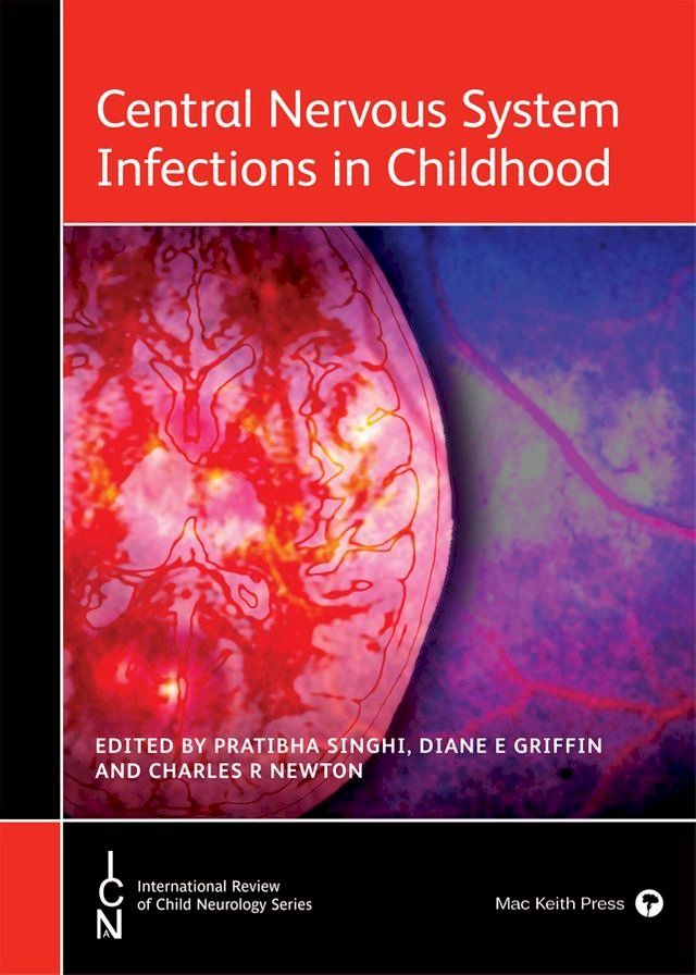  Central Nervous System Infections in Childhood(Kobo/電子書)