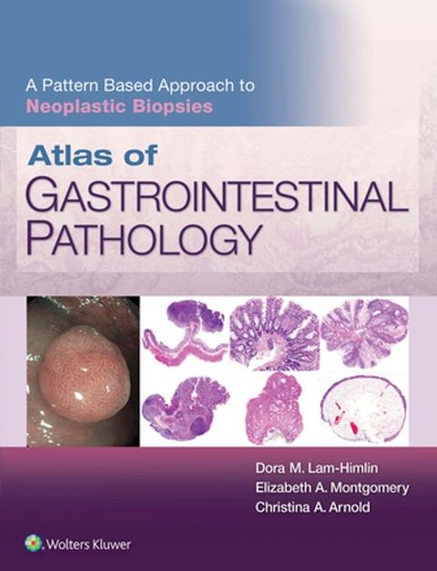 Atlas of Gastrointestinal Pathology: A Pattern Based Approach to Neoplastic Biopsies(Kobo/電子書)