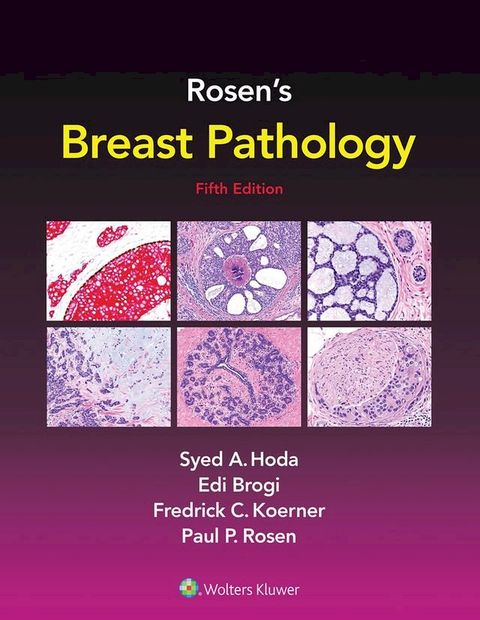 Rosen's Breast Pathology(Kobo/電子書)