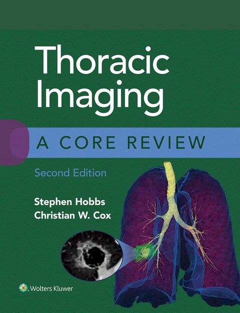 Thoracic Imaging: A Core Review(Kobo/電子書)