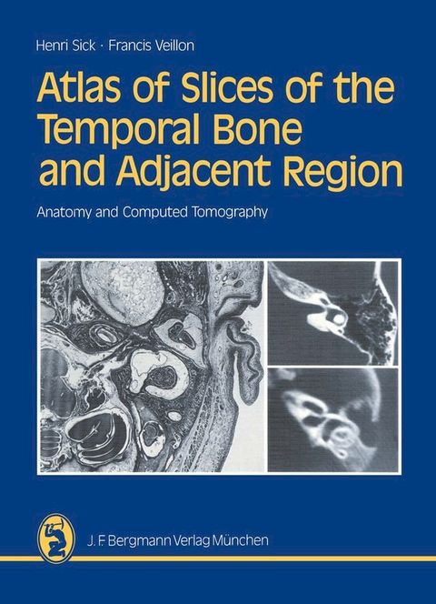 Atlas of Slices of the Temporal Bone and Adjacent Region(Kobo/電子書)