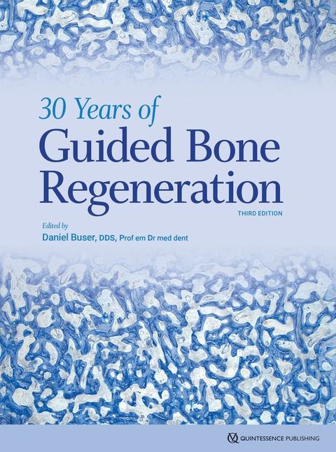 30 Years of Guided Bone Regeneration(Kobo/電子書)