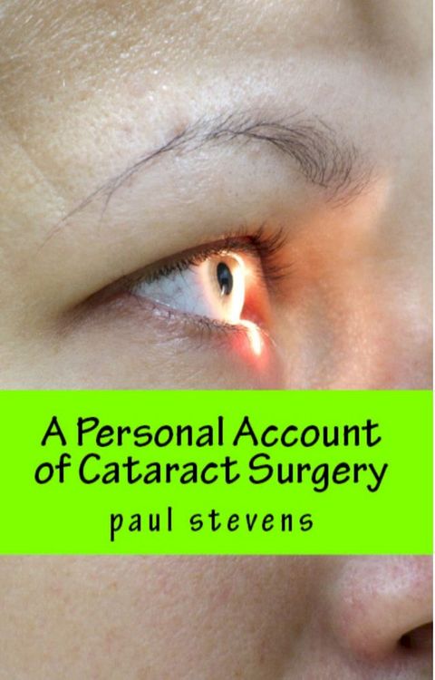 A Personal Account of Cataract Surgery(Kobo/電子書)