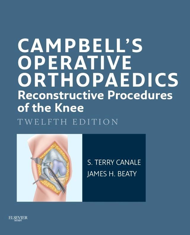  Campbell's Operative Orthopaedics: Reconstructive Procedures of the Knee E-Book(Kobo/電子書)