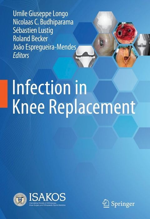 Infection in Knee Replacement(Kobo/電子書)