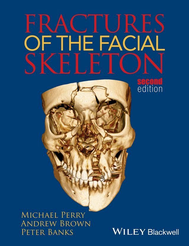  Fractures of the Facial Skeleton(Kobo/電子書)