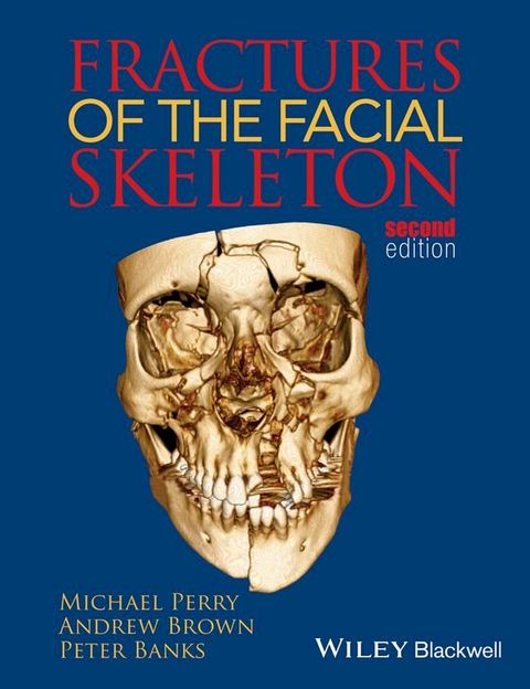 Fractures of the Facial Skeleton(Kobo/電子書)