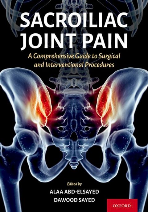 Sacroiliac Joint Pain(Kobo/電子書)