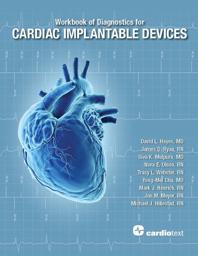  Workbook of Diagnostics for Cardiac Implantable Devices(Kobo/電子書)