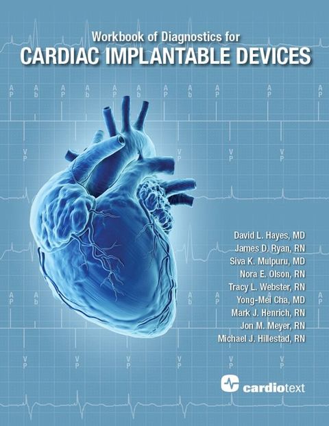 Workbook of Diagnostics for Cardiac Implantable Devices(Kobo/電子書)