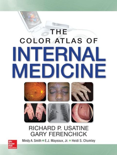 Color Atlas of Internal Medicine(Kobo/電子書)