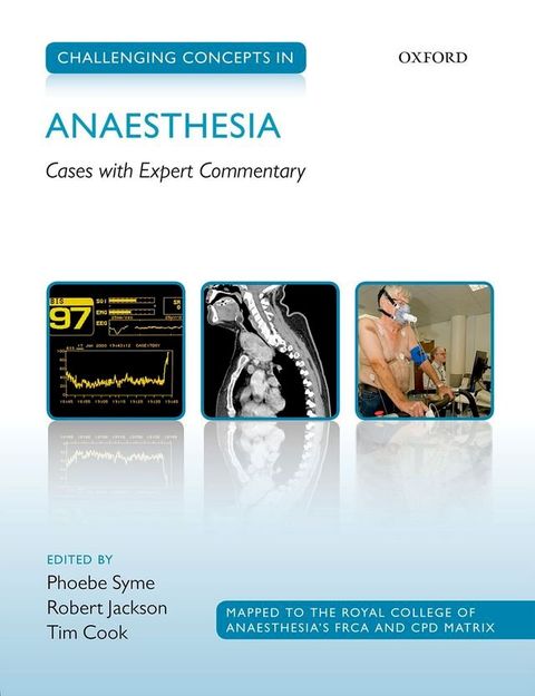 Challenging Concepts in Anaesthesia(Kobo/電子書)