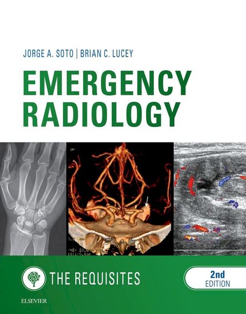 Emergency Radiology: The Requisites(Kobo/電子書)