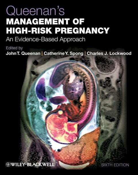 Queenan's Management of High-Risk Pregnancy(Kobo/電子書)