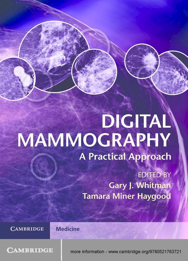  Digital Mammography(Kobo/電子書)