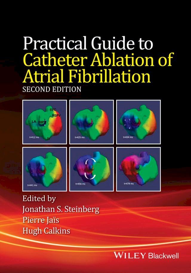  Practical Guide to Catheter Ablation of Atrial Fibrillation(Kobo/電子書)