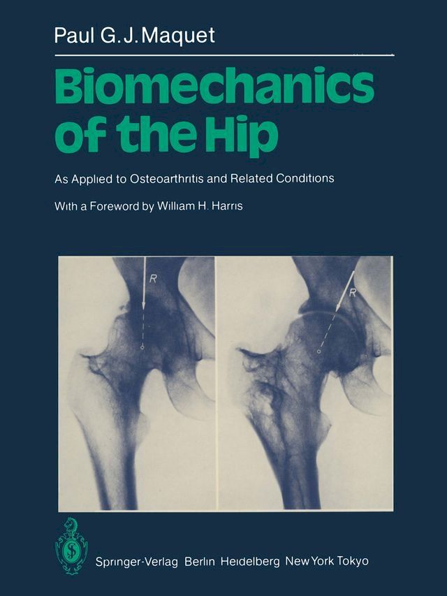  Biomechanics of the Hip(Kobo/電子書)