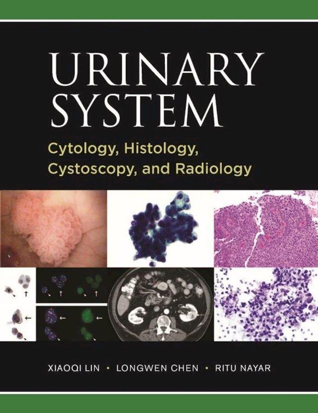  Urinary System: Cytology, Histology, Cystoscopy, and Radiology(Kobo/電子書)