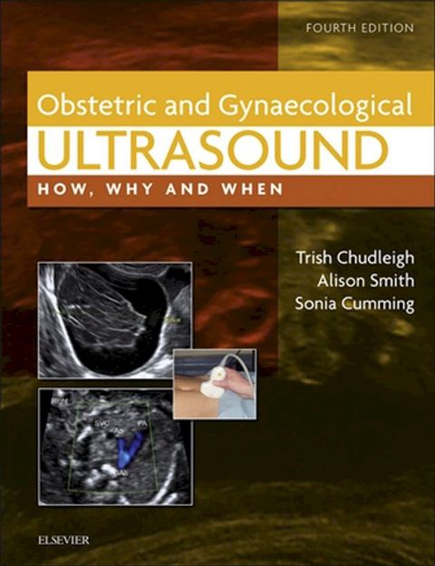 Obstetric & Gynaecological Ultrasound(Kobo/電子書)