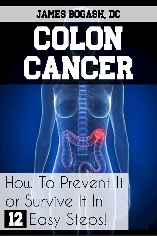  Colon Cancer: How to Prevent it or Survive it in 12 Easy Steps(Kobo/電子書)