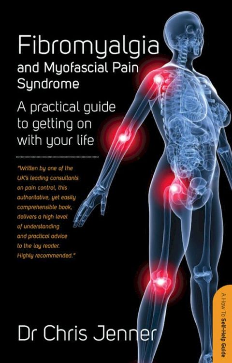 Fibromyalgia and Myofascial Pain Syndrome(Kobo/電子書)